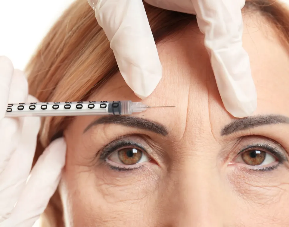 Close-up of a Botox treatment targeting facial expression lines