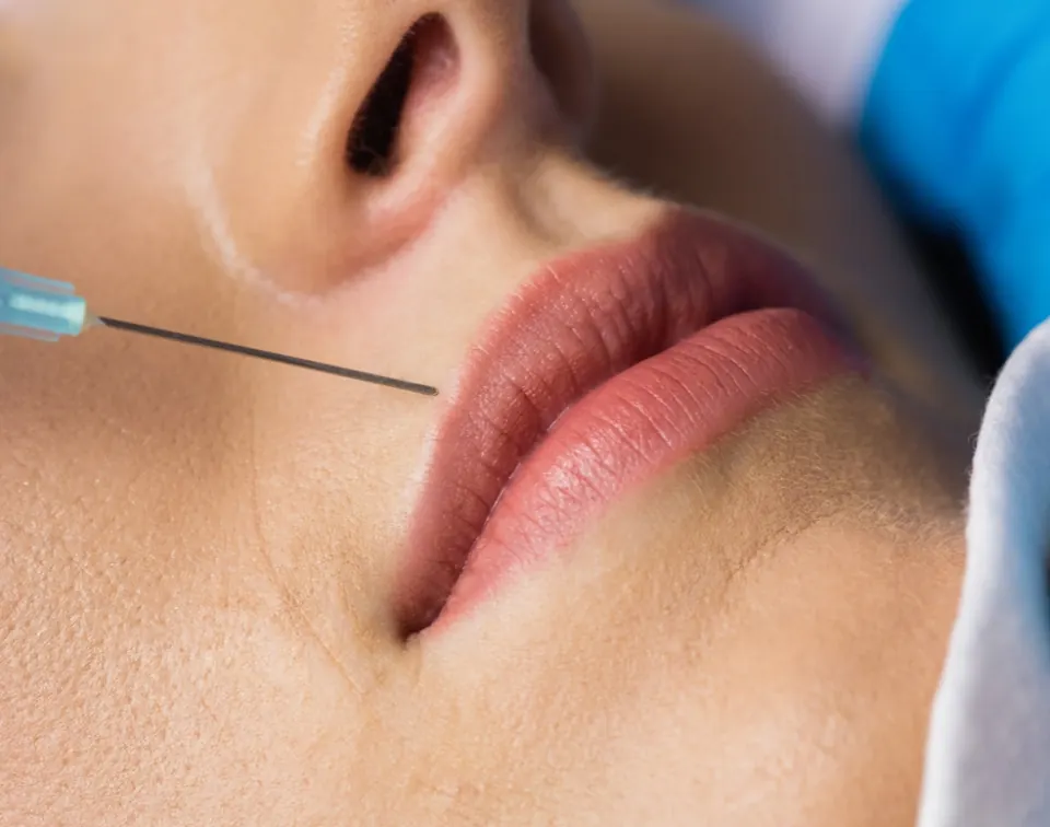 Lip augmentation consultation at Functional Wellness & Aesthetics in Salem, Oregon