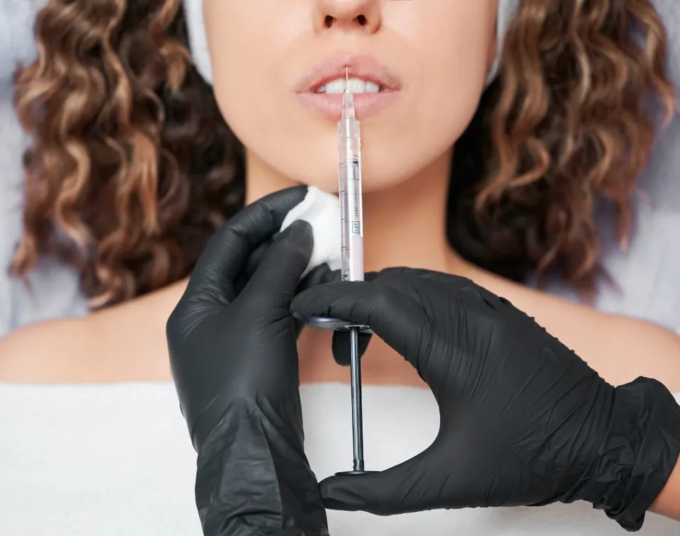 Lip filler treatment at Functional Wellness & Aesthetics in Salem, Oregon