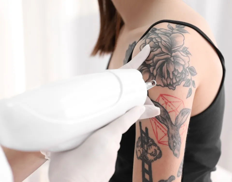 A tattoo removal consultation at Functional Wellness & Aesthetics