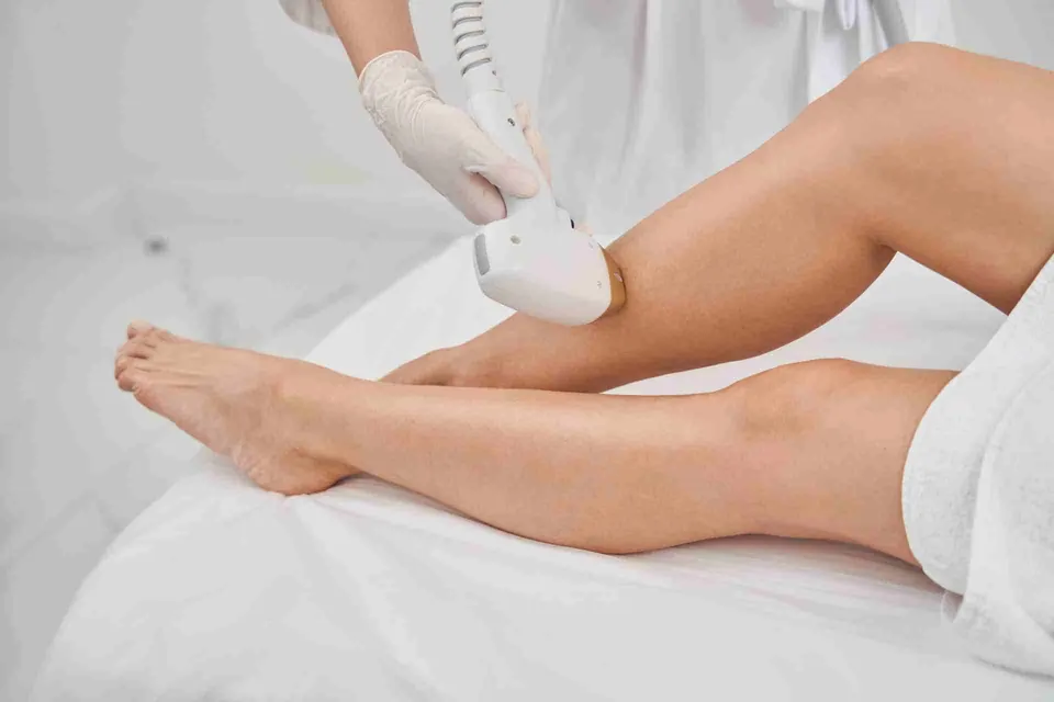 Laser hair removal treatment