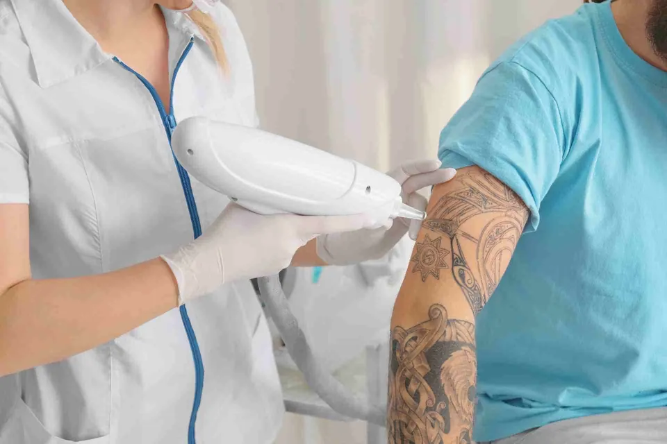 Tattoo reduction laser device