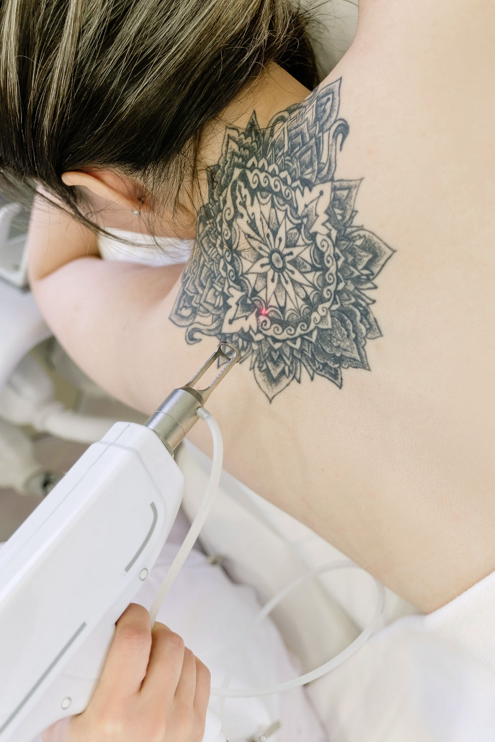 Laser Tattoo Removal | Windam, NH | Lasting Beauty