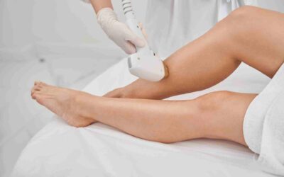 Does Laser Hair Removal Affect Tattoos?