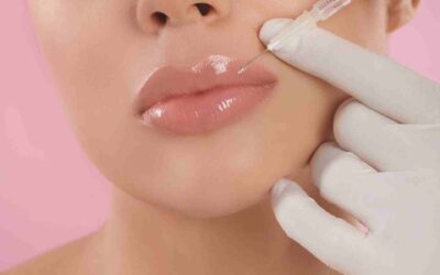 When Was Lip Filler Invented? Tracing the History of a Beauty Staple