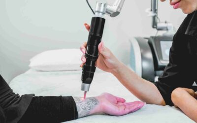 Comparing Tattoo Removal Methods: Laser, Surgical & More