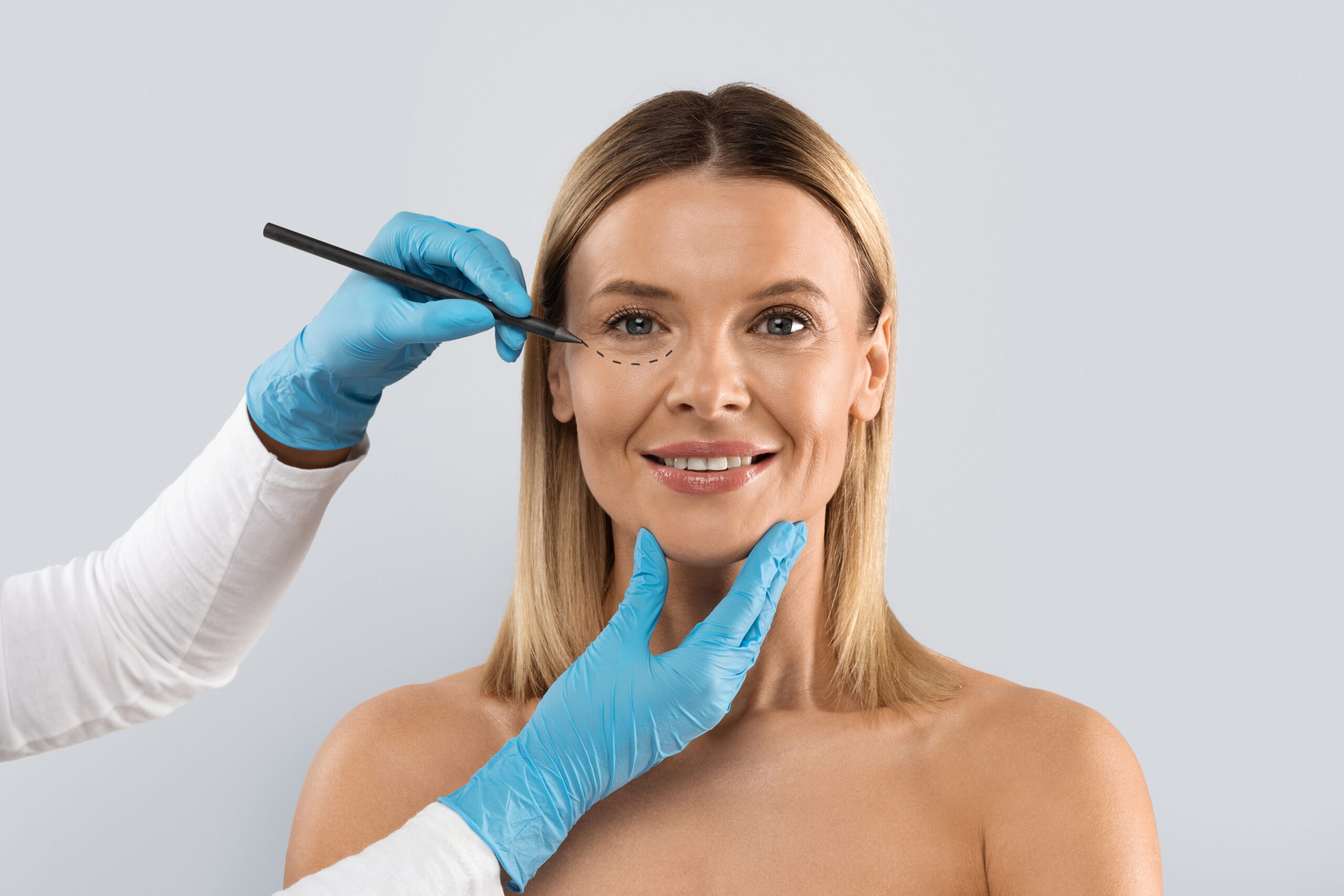 Surgeon drawing perforation lines on woman face for plastic surgery