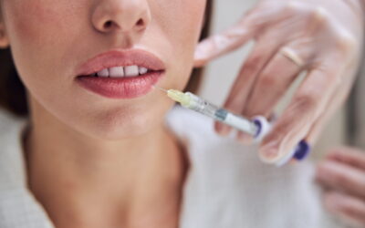 How Much is Lip Filler?