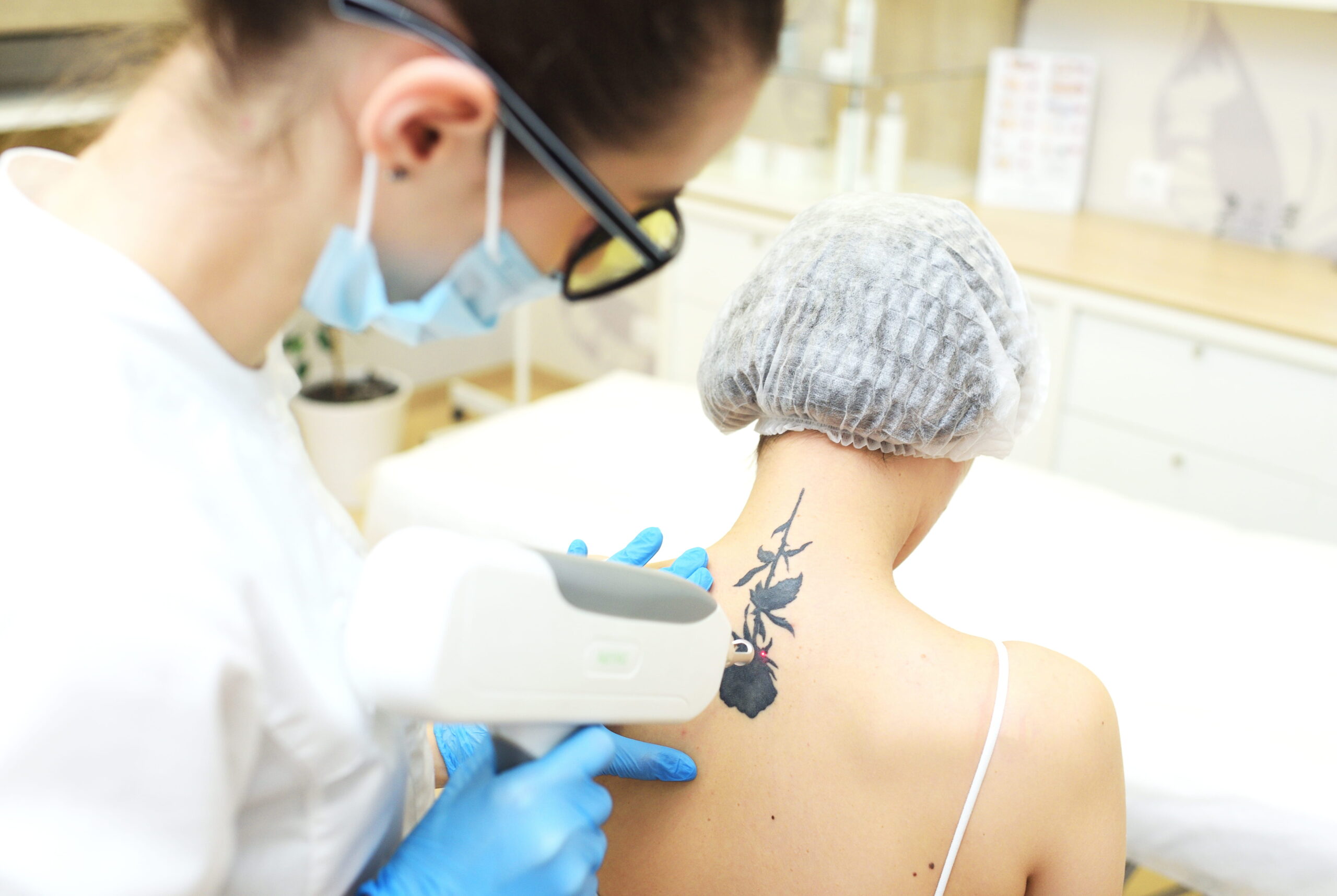 Woman Receiving Tattoo Removal Treatment in Clinic